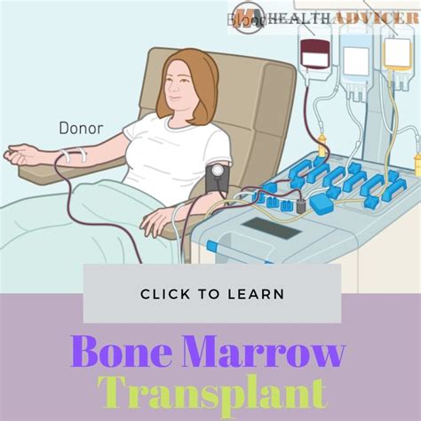 bone marrow transplant pcso|Bone Marrow Transplant: Preparation, Procedure, Risks, and Recovery .